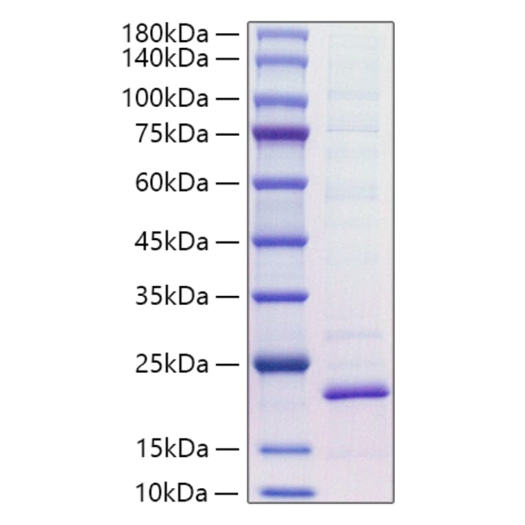 SDS-PAGE - Recombinant Mouse IL-18 Protein (C-terminal His Tag) (A330838) - Antibodies.com