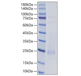 SDS-PAGE - Recombinant Rat IL-18 Protein (C-terminal His Tag) (A330839) - Antibodies.com