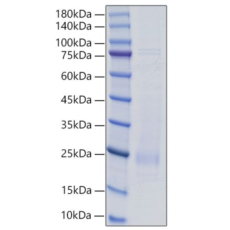 SDS-PAGE - Recombinant Rat IL-18 Protein (C-terminal His Tag) (A330839) - Antibodies.com