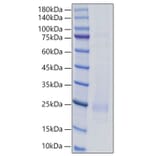 SDS-PAGE - Recombinant Rat IL-18 Protein (C-terminal His Tag) (A330839) - Antibodies.com