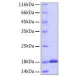 SDS-PAGE - Recombinant Human IL-18 Protein (A330840) - Antibodies.com