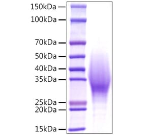 SDS-PAGE - Recombinant Mouse IL-18BP Protein (C-terminal His Tag) (A330841) - Antibodies.com