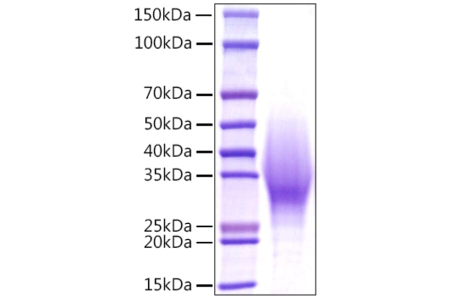SDS-PAGE - Recombinant Mouse IL-18BP Protein (C-terminal His Tag) (A330841) - Antibodies.com