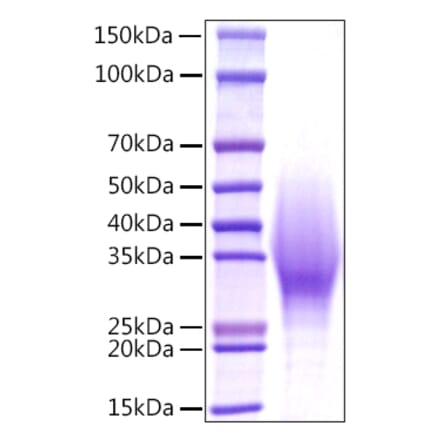 SDS-PAGE - Recombinant Mouse IL-18BP Protein (C-terminal His Tag) (A330841) - Antibodies.com