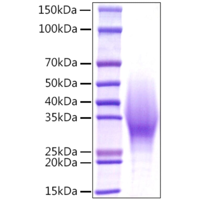 SDS-PAGE - Recombinant Mouse IL-18BP Protein (C-terminal His Tag) (A330841) - Antibodies.com