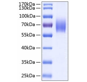 SDS-PAGE - Recombinant Human IL-18BP Protein (C-terminal Human Fc and His Tag) (A330842) - Antibodies.com