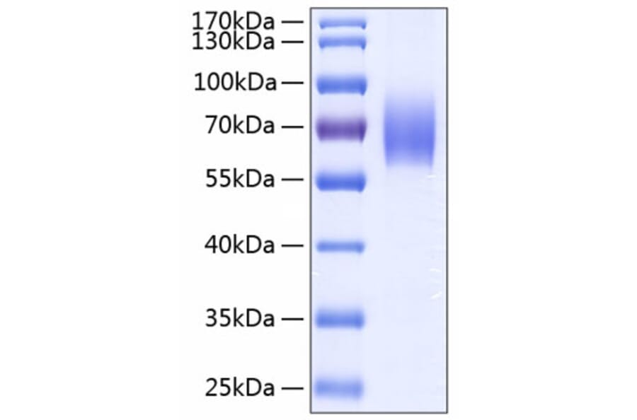 SDS-PAGE - Recombinant Human IL-18BP Protein (C-terminal Human Fc and His Tag) (A330842) - Antibodies.com