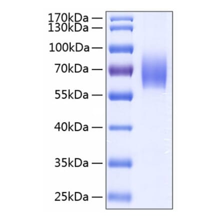 SDS-PAGE - Recombinant Human IL-18BP Protein (C-terminal Human Fc and His Tag) (A330842) - Antibodies.com