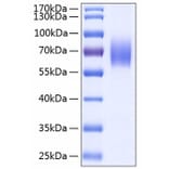 SDS-PAGE - Recombinant Human IL-18BP Protein (C-terminal Human Fc and His Tag) (A330842) - Antibodies.com