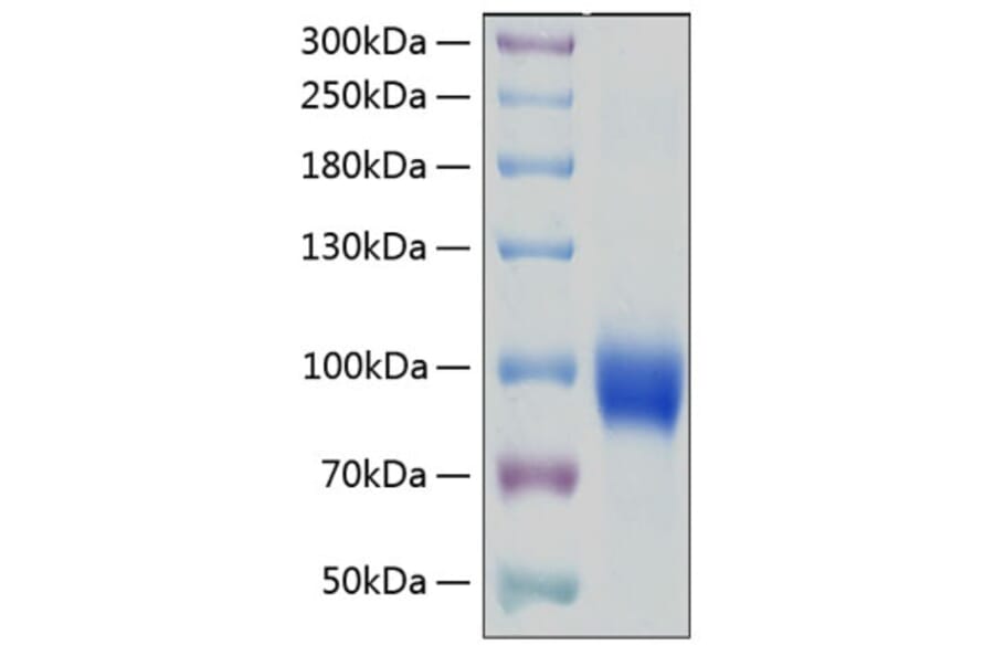 SDS-PAGE - Recombinant Human IL-18R1 Protein (C-terminal Human Fc and His Tag) (A330844) - Antibodies.com