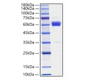SDS-PAGE - Recombinant Mouse IL-19 Protein (C-terminal Human Fc Tag) (A330845) - Antibodies.com