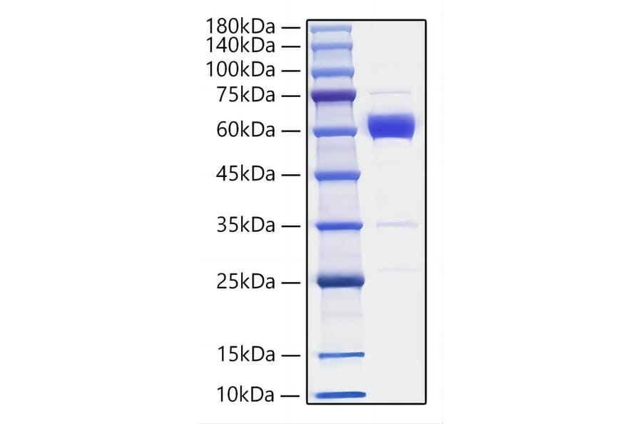 SDS-PAGE - Recombinant Mouse IL-19 Protein (C-terminal Human Fc Tag) (A330845) - Antibodies.com