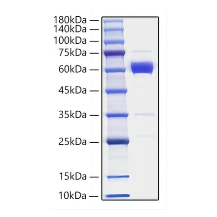 SDS-PAGE - Recombinant Mouse IL-19 Protein (C-terminal Human Fc Tag) (A330845) - Antibodies.com