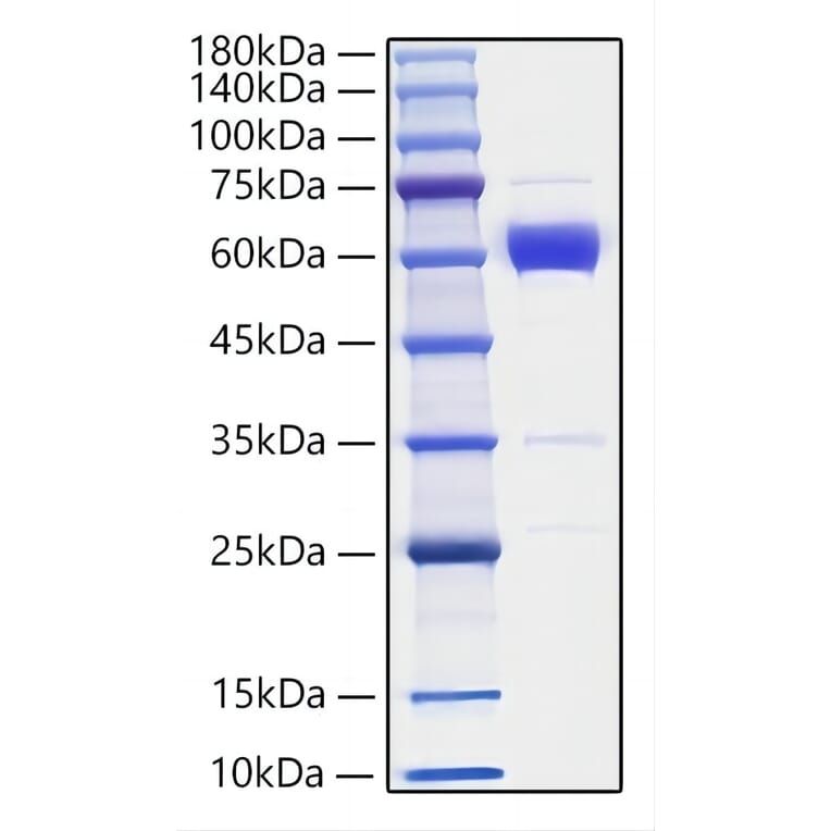 SDS-PAGE - Recombinant Mouse IL-19 Protein (C-terminal Human Fc Tag) (A330845) - Antibodies.com