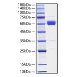 SDS-PAGE - Recombinant Mouse IL-19 Protein (C-terminal Human Fc Tag) (A330845) - Antibodies.com