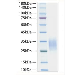 SDS-PAGE - Recombinant Mouse IL-19 Protein (C-terminal His Tag) (A330846) - Antibodies.com