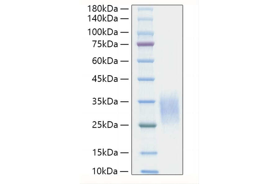 SDS-PAGE - Recombinant Mouse IL-19 Protein (C-terminal His Tag) (A330846) - Antibodies.com