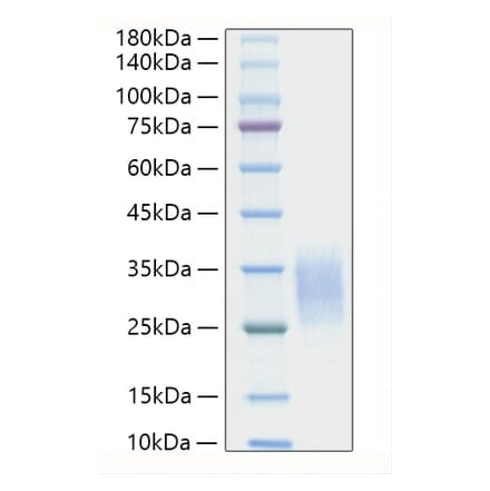 SDS-PAGE - Recombinant Mouse IL-19 Protein (C-terminal His Tag) (A330846) - Antibodies.com
