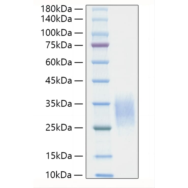 SDS-PAGE - Recombinant Mouse IL-19 Protein (C-terminal His Tag) (A330846) - Antibodies.com