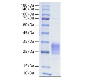 SDS-PAGE - Recombinant Human IL-19 Protein (C-terminal His Tag) (A330847) - Antibodies.com