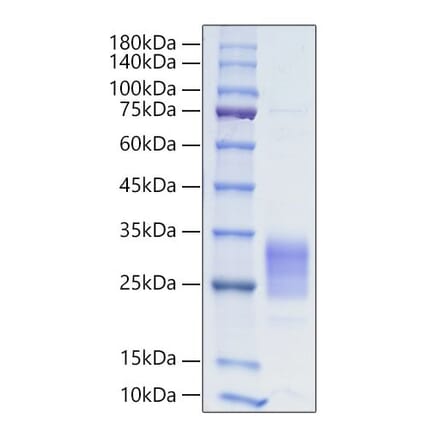 SDS-PAGE - Recombinant Human IL-19 Protein (C-terminal His Tag) (A330847) - Antibodies.com