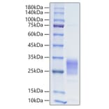 SDS-PAGE - Recombinant Human IL-19 Protein (C-terminal His Tag) (A330847) - Antibodies.com