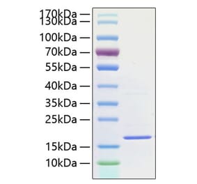 SDS-PAGE - Recombinant Human IL-1F10 Protein (A330848) - Antibodies.com