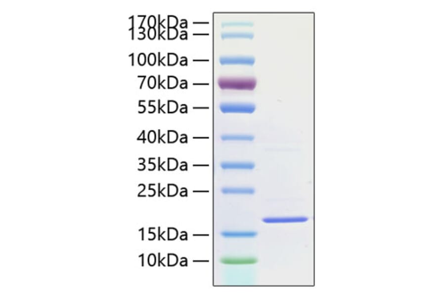 SDS-PAGE - Recombinant Human IL-1F10 Protein (A330848) - Antibodies.com