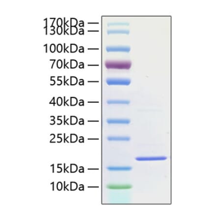 SDS-PAGE - Recombinant Human IL-1F10 Protein (A330848) - Antibodies.com