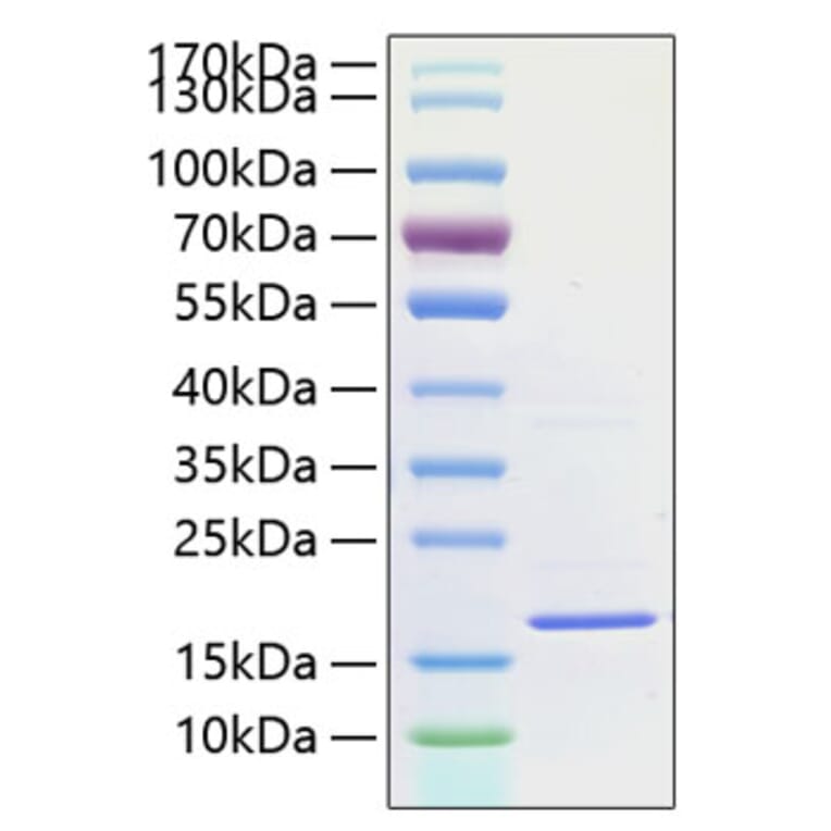 SDS-PAGE - Recombinant Human IL-1F10 Protein (A330848) - Antibodies.com