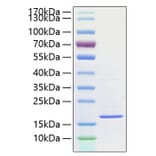 SDS-PAGE - Recombinant Human IL-1F10 Protein (A330848) - Antibodies.com