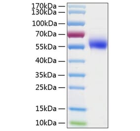 SDS-PAGE - Recombinant Human IL-1R-2 Protein (C-terminal His Tag) (A330849) - Antibodies.com
