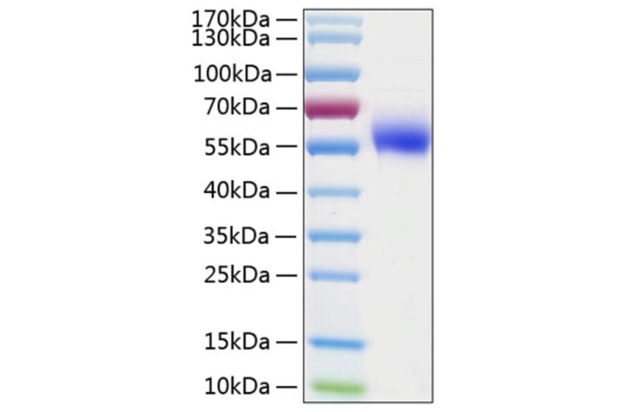 SDS-PAGE - Recombinant Human IL-1R-2 Protein (C-terminal His Tag) (A330849) - Antibodies.com