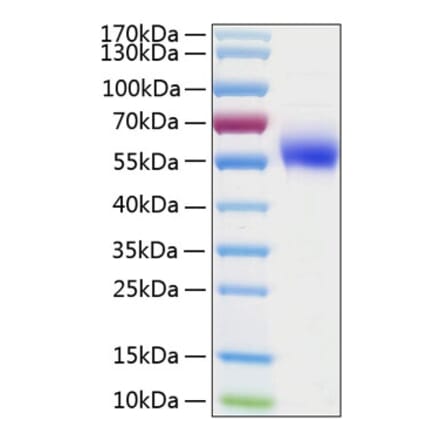 SDS-PAGE - Recombinant Human IL-1R-2 Protein (C-terminal His Tag) (A330849) - Antibodies.com