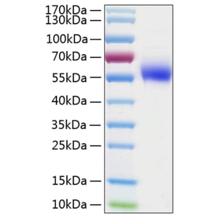 SDS-PAGE - Recombinant Human IL-1R-2 Protein (C-terminal His Tag) (A330849) - Antibodies.com