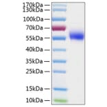 SDS-PAGE - Recombinant Human IL-1R-2 Protein (C-terminal His Tag) (A330849) - Antibodies.com