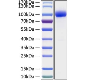 SDS-PAGE - Recombinant Human IL-1R-2 Protein (C-terminal Human Fc and His Tag) (A330850) - Antibodies.com