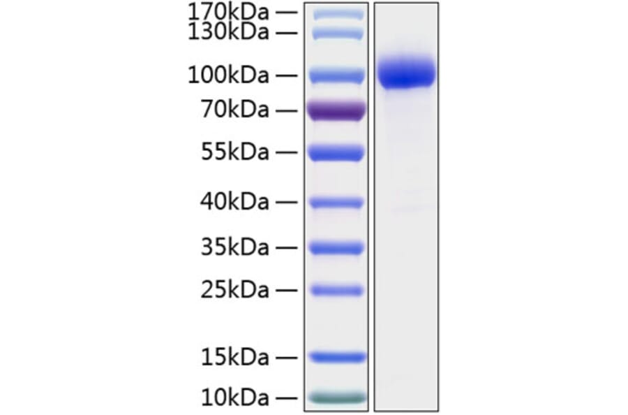 SDS-PAGE - Recombinant Human IL-1R-2 Protein (C-terminal Human Fc and His Tag) (A330850) - Antibodies.com