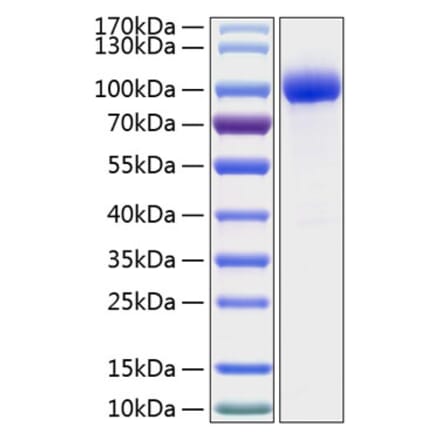 SDS-PAGE - Recombinant Human IL-1R-2 Protein (C-terminal Human Fc and His Tag) (A330850) - Antibodies.com