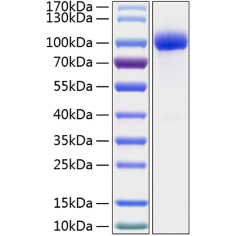 SDS-PAGE - Recombinant Human IL-1R-2 Protein (C-terminal Human Fc and His Tag) (A330850) - Antibodies.com