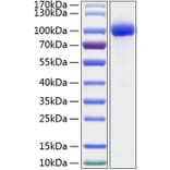 SDS-PAGE - Recombinant Human IL-1R-2 Protein (C-terminal Human Fc and His Tag) (A330850) - Antibodies.com