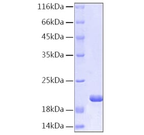 SDS-PAGE - Recombinant Human IL-1RA Protein (C-terminal His Tag) (A330851) - Antibodies.com