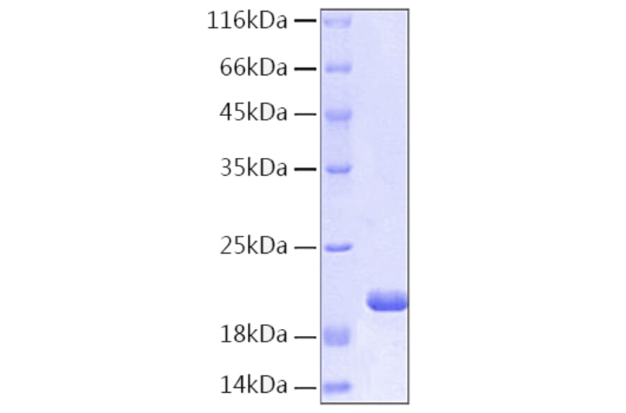 SDS-PAGE - Recombinant Human IL-1RA Protein (C-terminal His Tag) (A330851) - Antibodies.com
