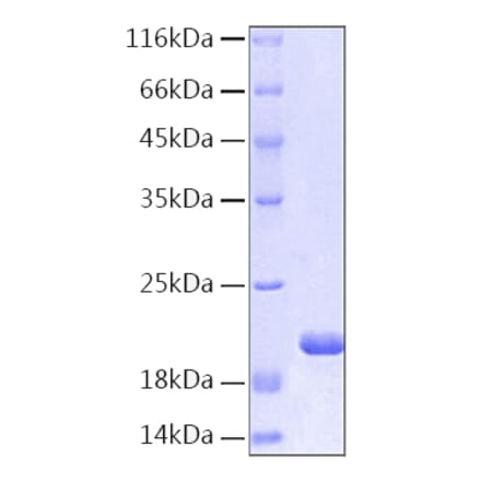 SDS-PAGE - Recombinant Human IL-1RA Protein (C-terminal His Tag) (A330851) - Antibodies.com