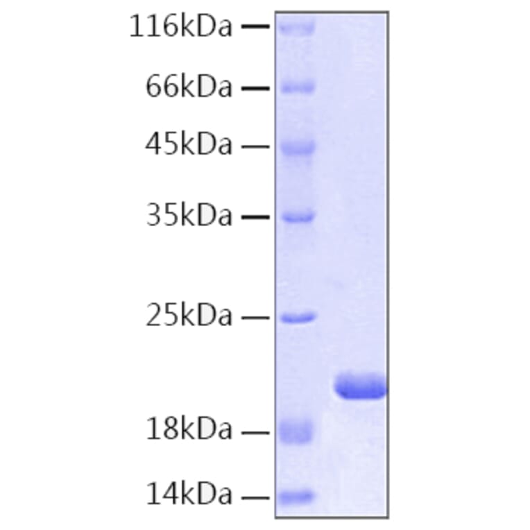 SDS-PAGE - Recombinant Human IL-1RA Protein (C-terminal His Tag) (A330851) - Antibodies.com