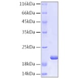 SDS-PAGE - Recombinant Human IL-1RA Protein (C-terminal His Tag) (A330851) - Antibodies.com