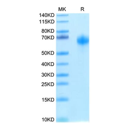 Tris-Bis PAGE - Recombinant Human IL-1RAcP Protein (Biotin) (C-terminal His and Avi Tag) (A330852) - Antibodies.com