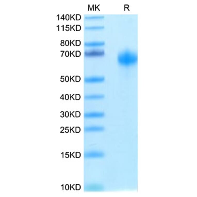 Tris-Bis PAGE - Recombinant Human IL-1RAcP Protein (Biotin) (C-terminal His and Avi Tag) (A330852) - Antibodies.com