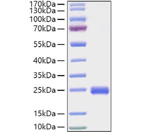 SDS-PAGE - Recombinant Mouse IL-2 Protein (C-terminal His Tag) (A330855) - Antibodies.com