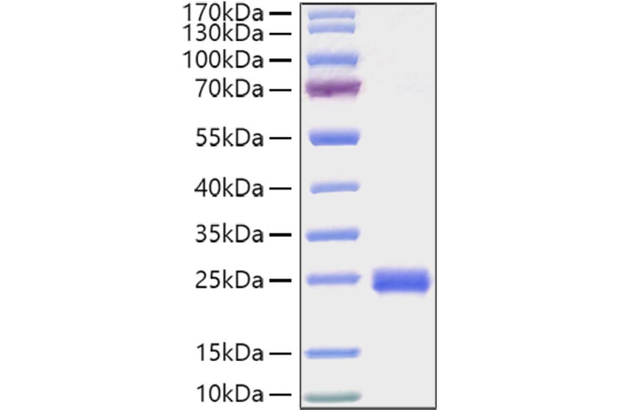 SDS-PAGE - Recombinant Mouse IL-2 Protein (C-terminal His Tag) (A330855) - Antibodies.com